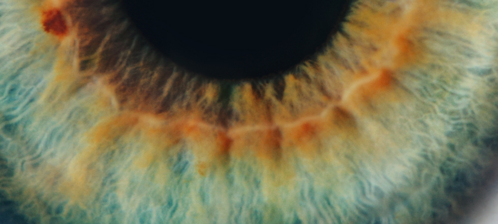Common Eye Conditions