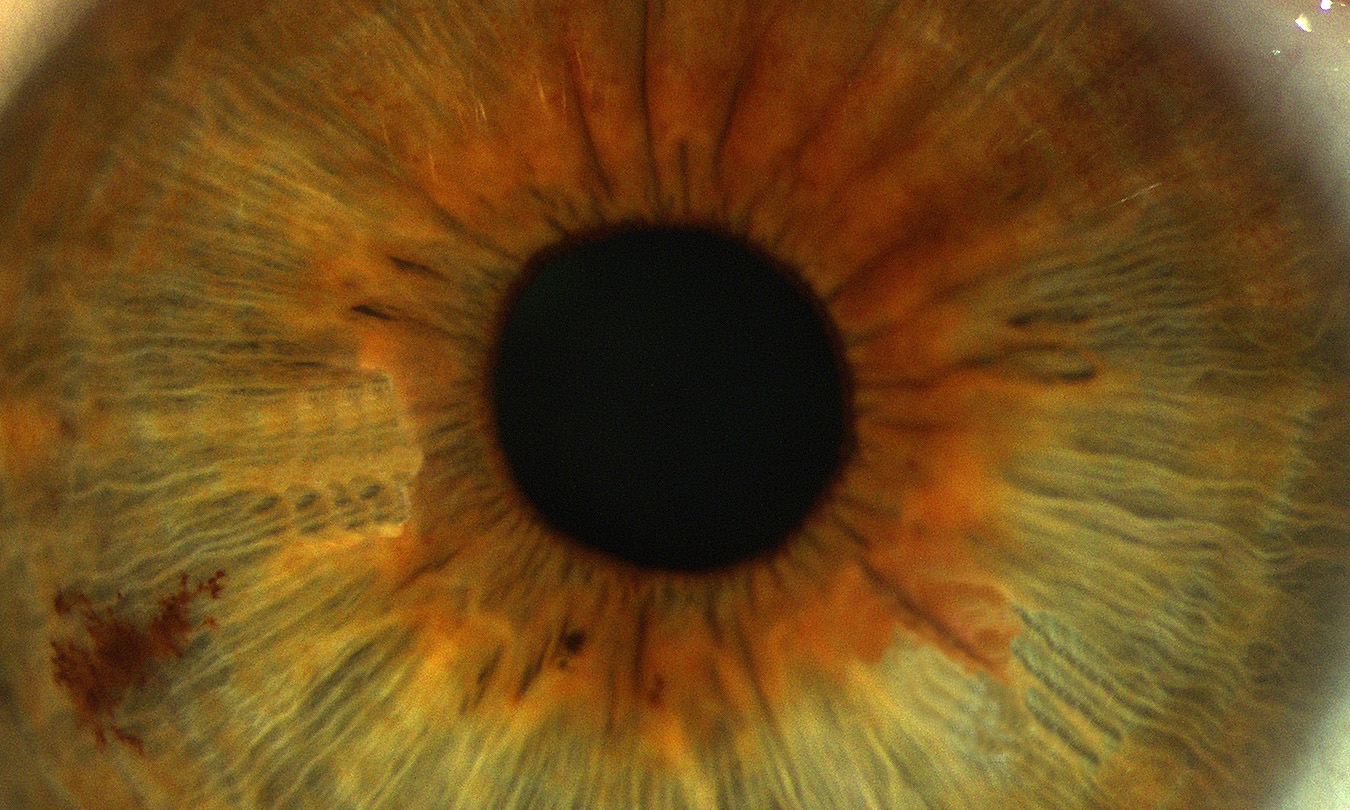 Iris